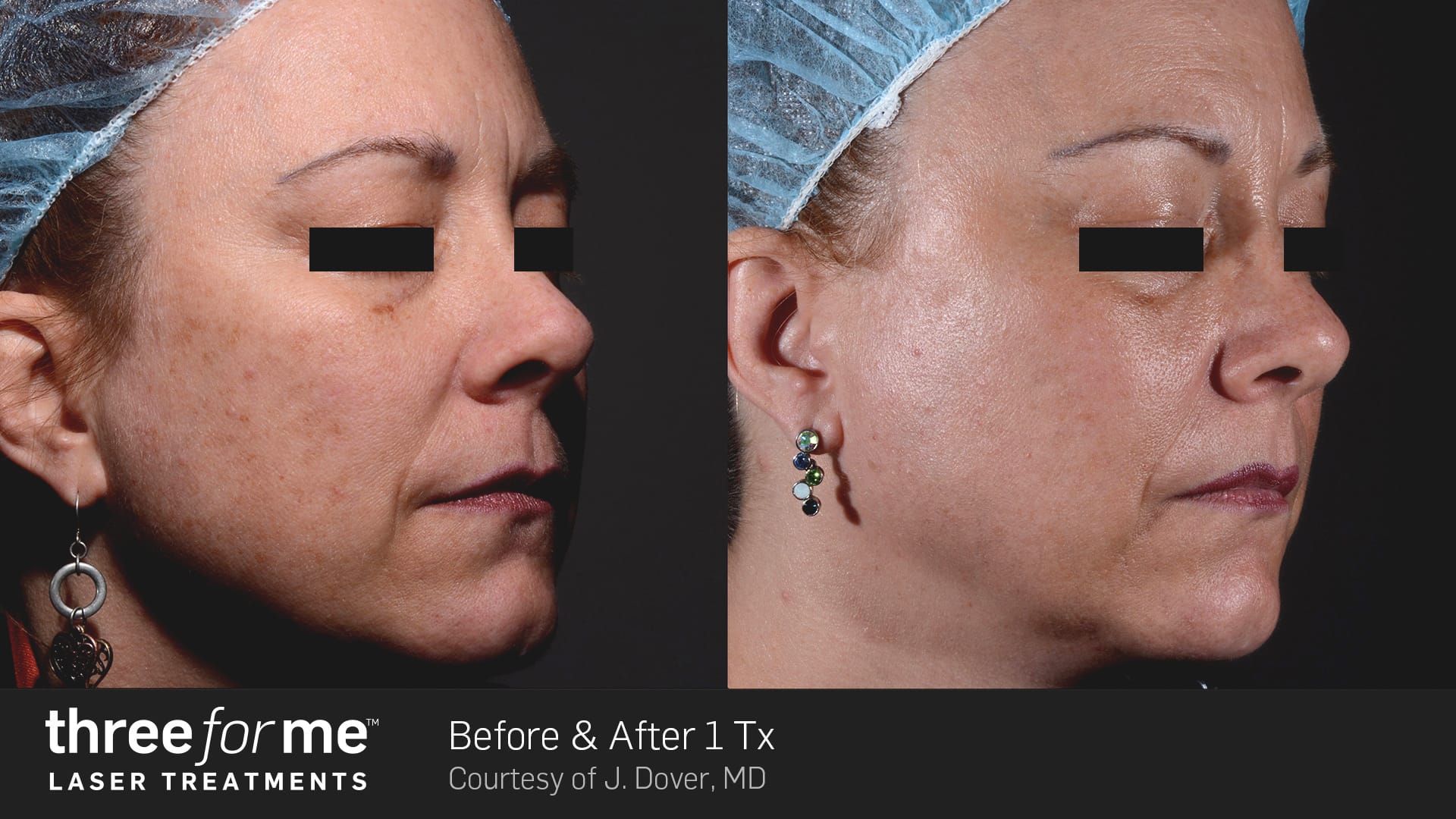 ThreeForMe-Before-26-After-Photo-1